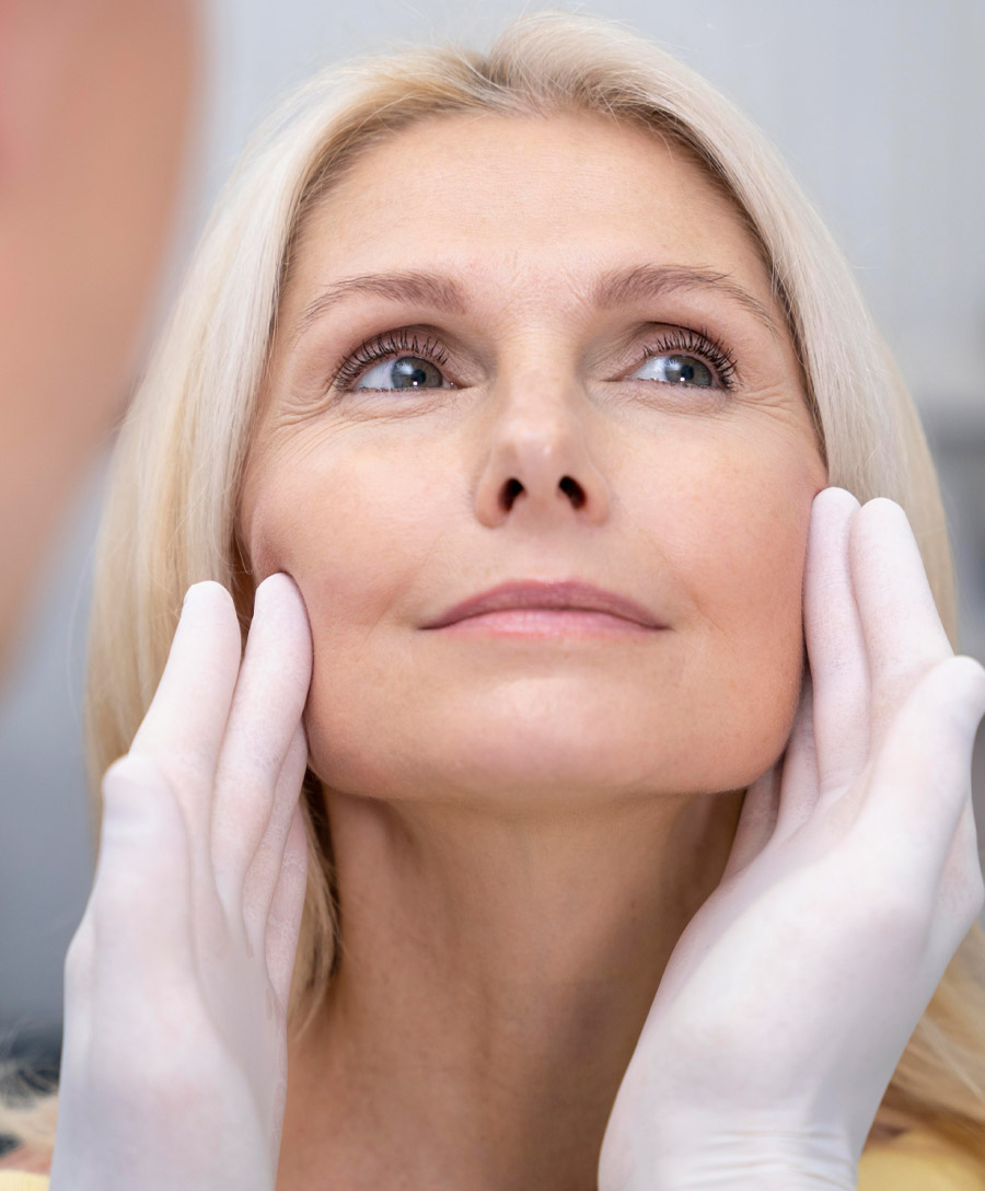 Facelift