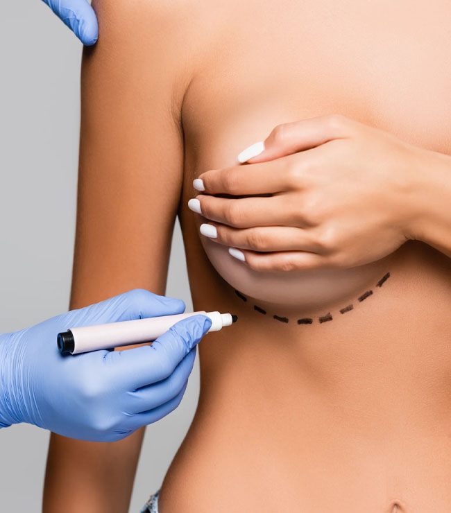 FEATURED Procedures - Breast Augmentation