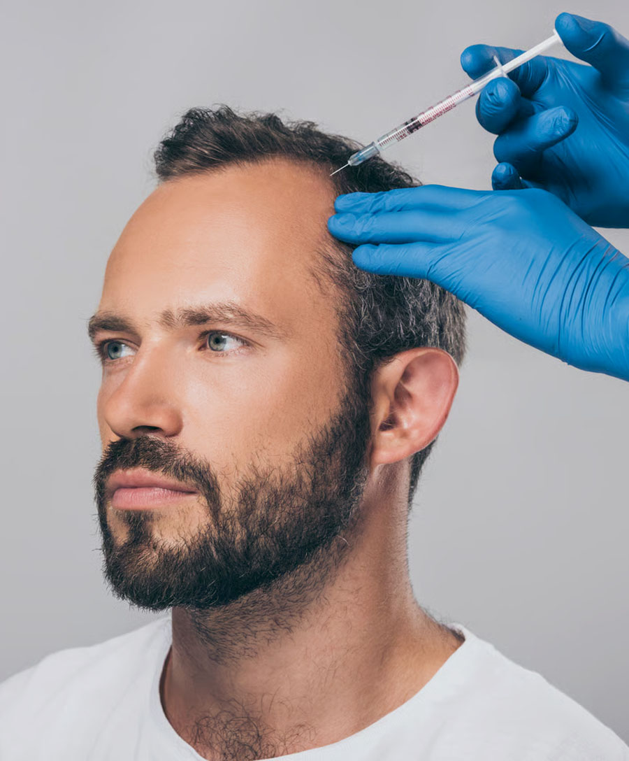 Hair Loss Treatment