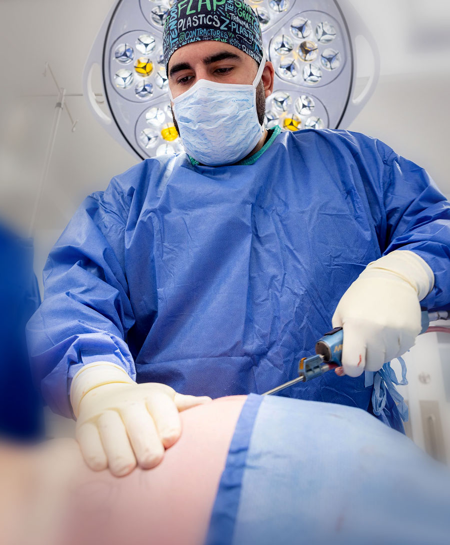 What Is Liposuction?