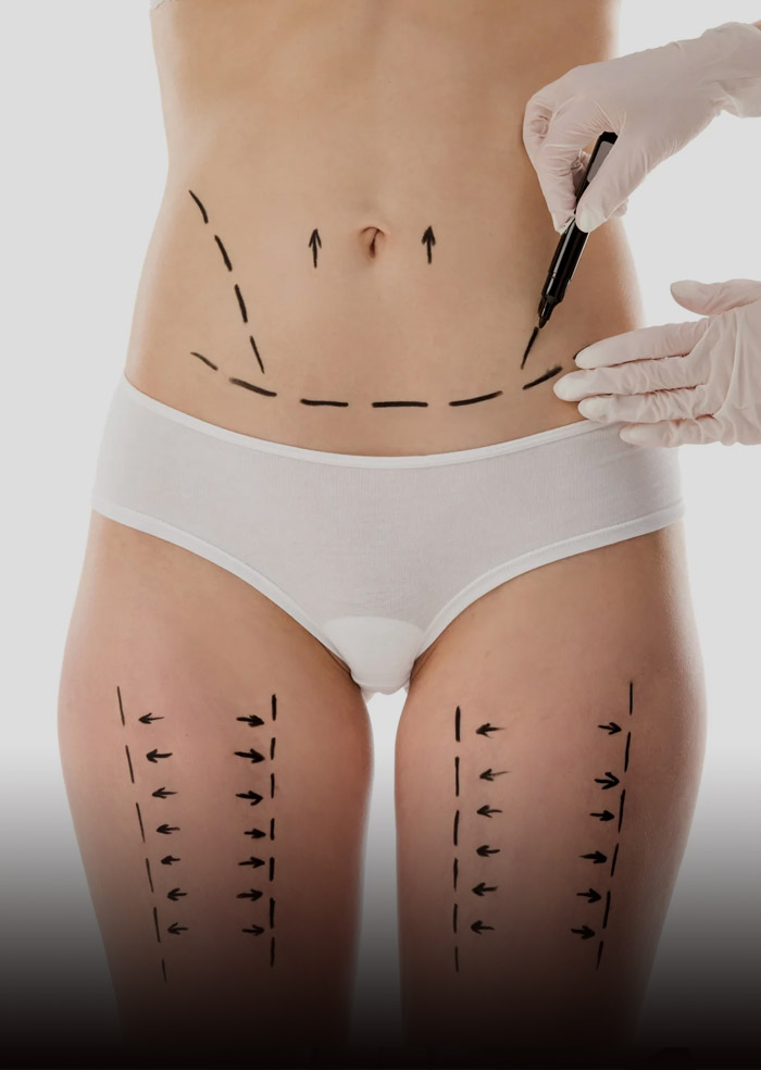 Body Procedures