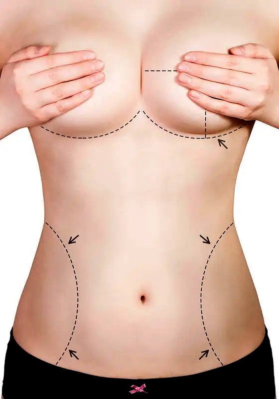 Mommy Makeover Surgery 